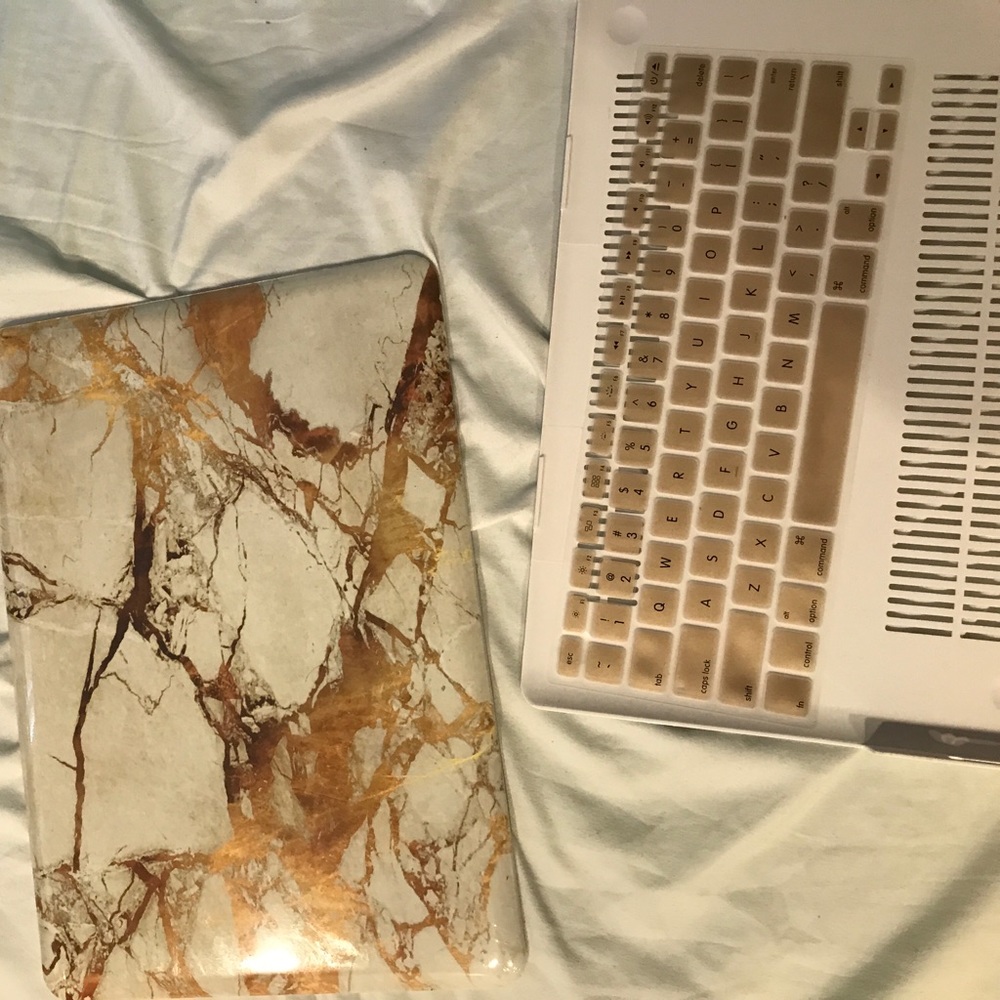 MacBook Pro 13 Inch Case. ♡