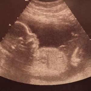 Meet your Posher, Eduardo