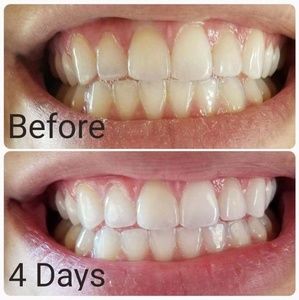 Amazing Toothpaste
