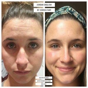 Rodan + Fields redefine regimen