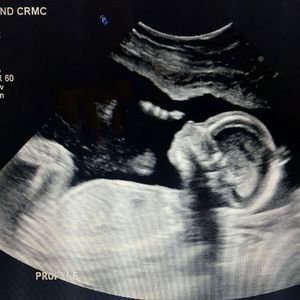 Meet your Posher, Cassandra