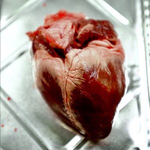 Meet your Posher, Cedric