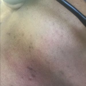 Meet your Posher, Misty