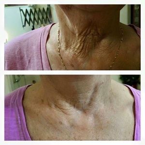 Body contouring cream- Firming cream