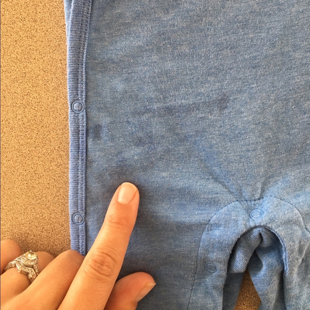 Photos of Marks on Onesie