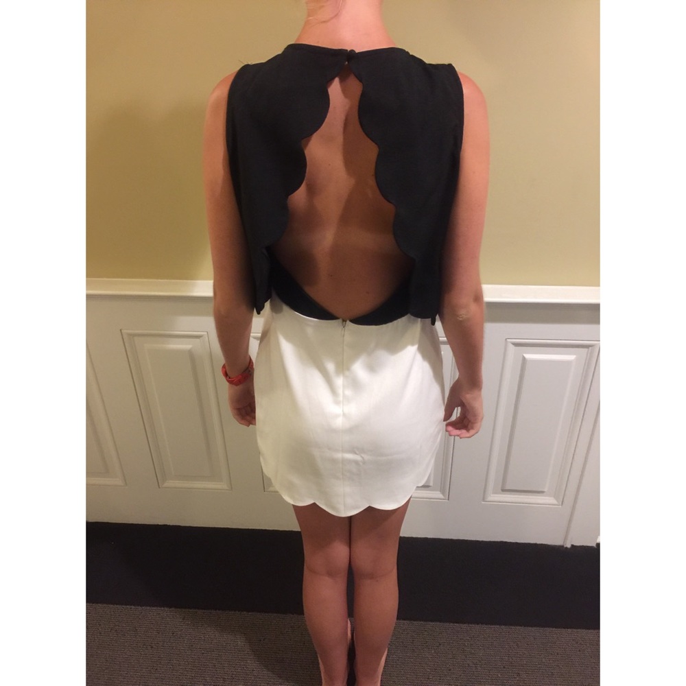 B&W Scalloped dress