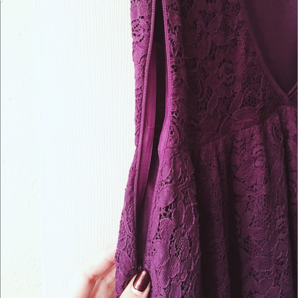 Pins & Needles Dress - Picture 5 of 5