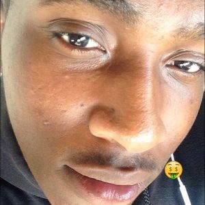 Meet your Posher, Dervon