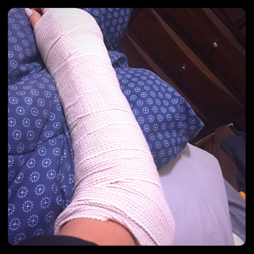 Surgery!!!!