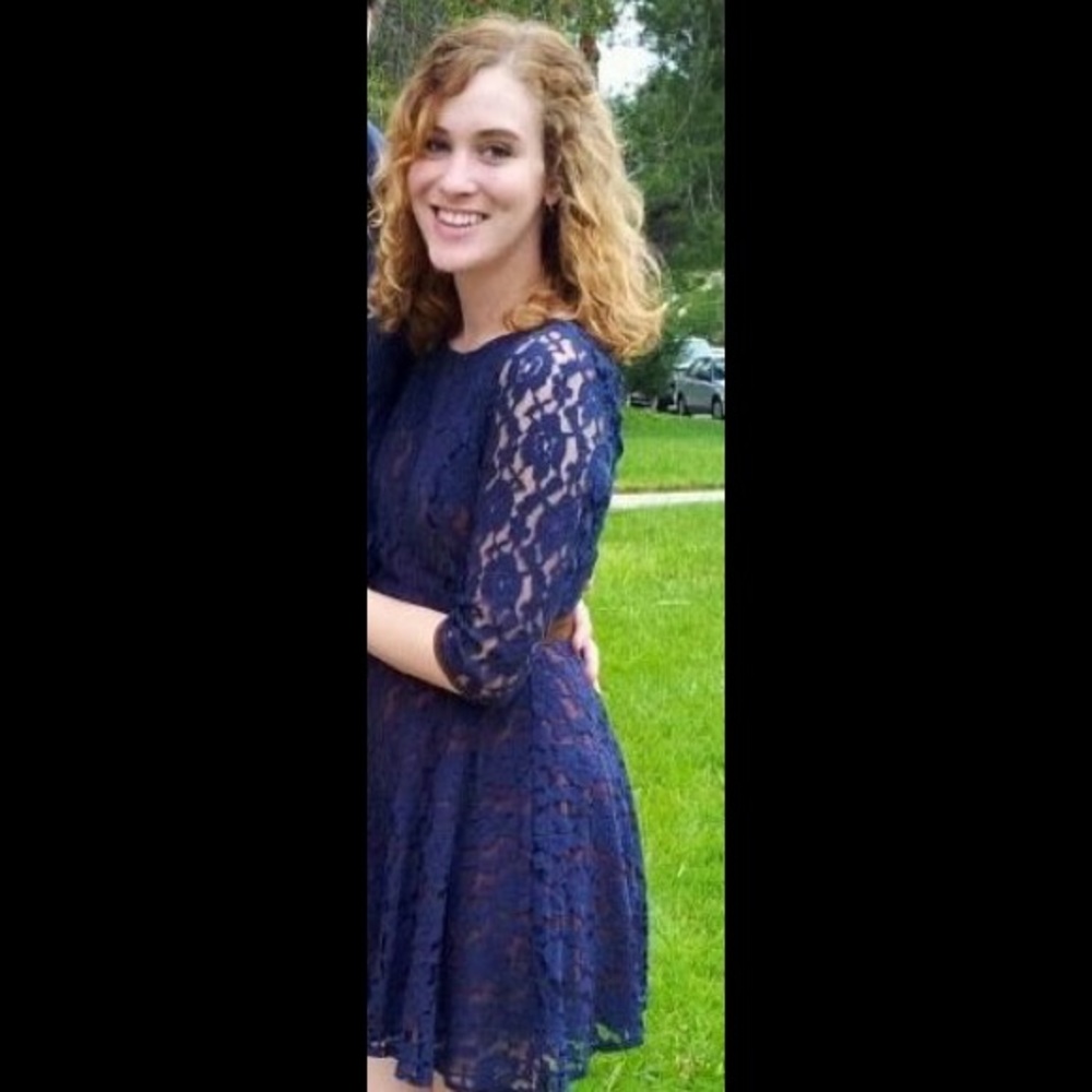 Gorgeous Modcloth Blue Lace Party Dress