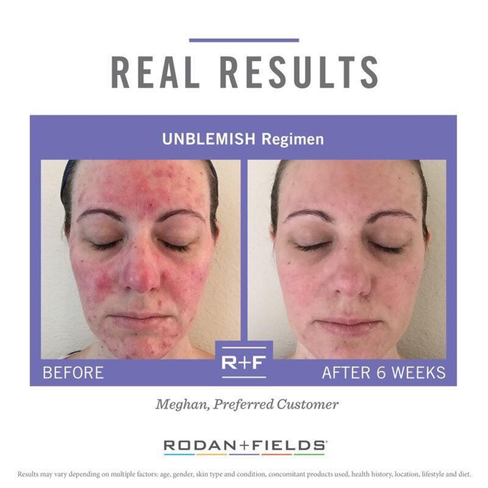 Unblemish face wash - Picture 3 of 4