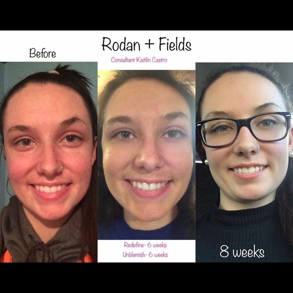 Unblemish face wash - Picture 2 of 4