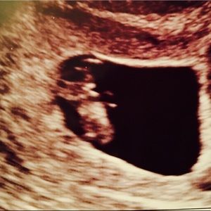 Meet your Posher, Wilson