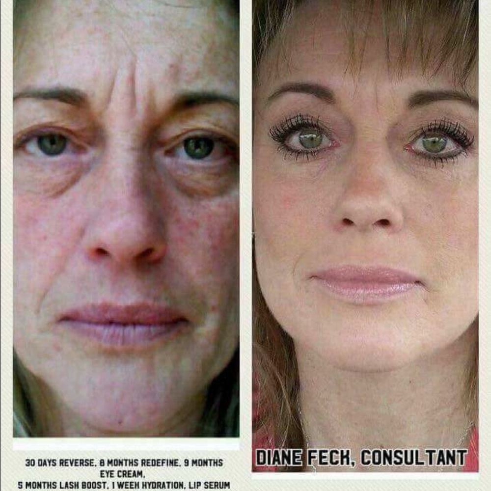 Rodan and fields skin care