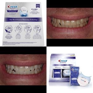 Crest Whitestrips with light