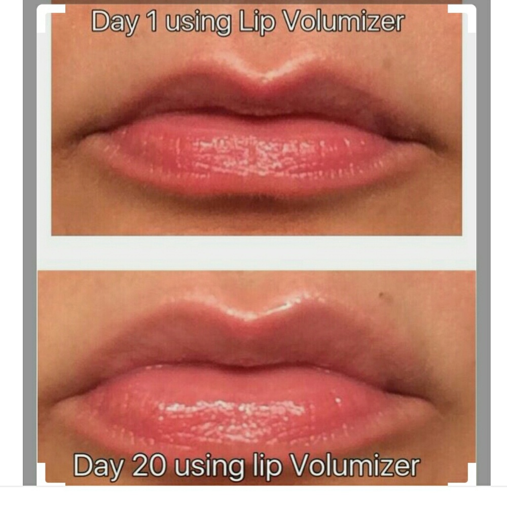 lip volumizer