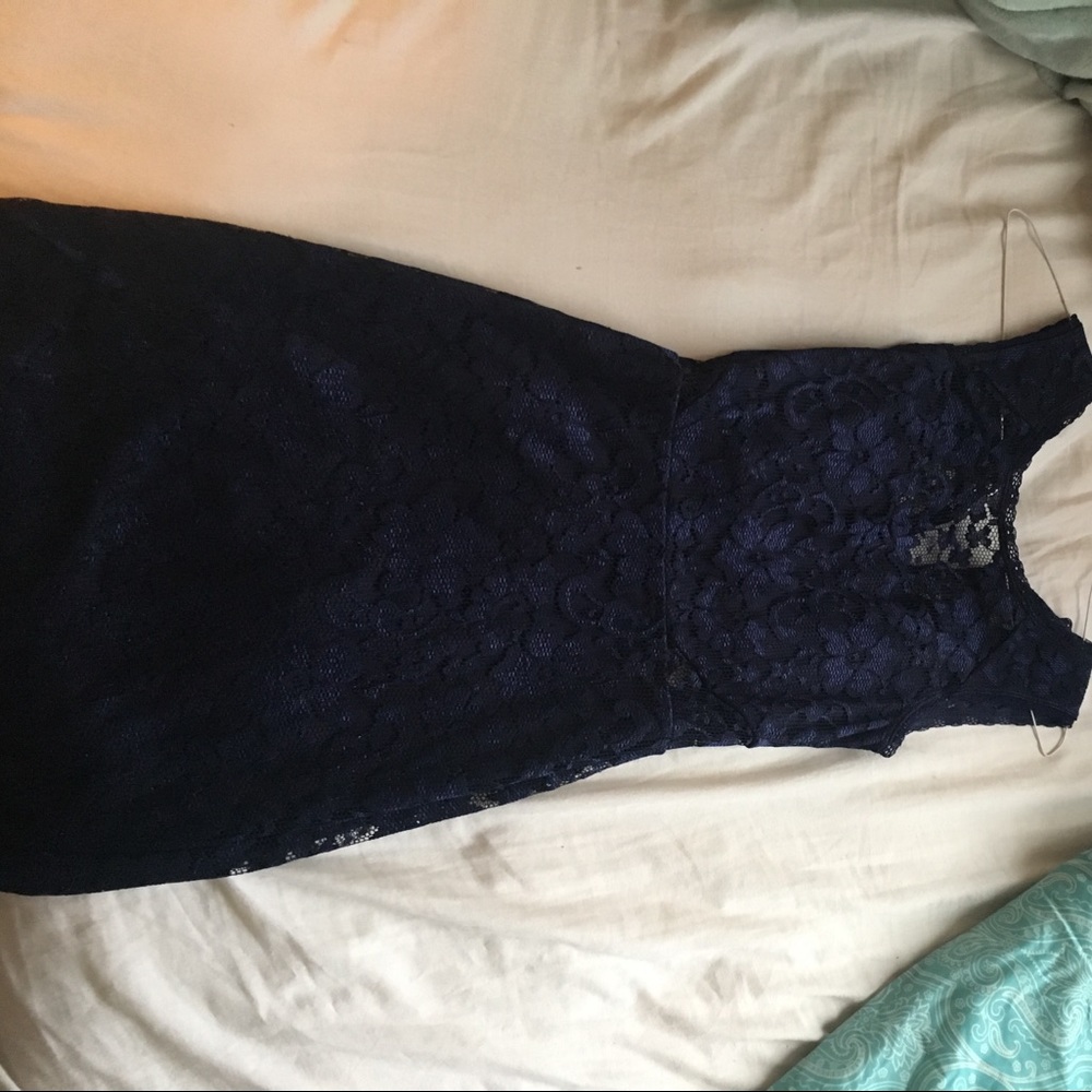 Lace forms dress