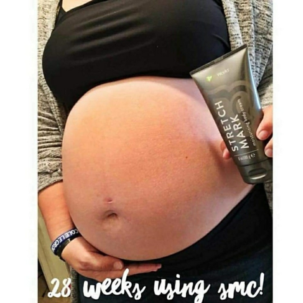 Stretch Mark Cream