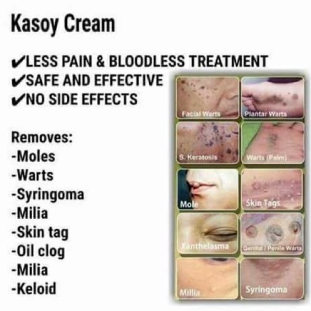 KASOY CREAM (Cashew Cream)