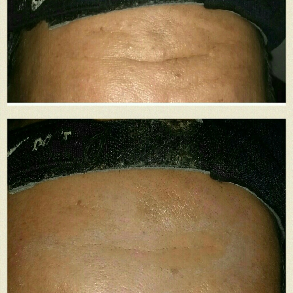 Wrinkle, puffy eye cream