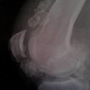 Meet your Posher, Shawn