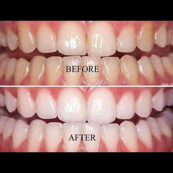 AP-24 - Picture 2 of 3