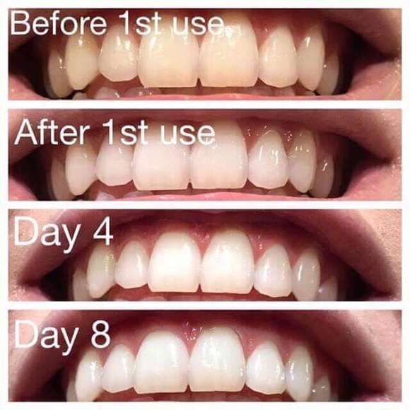 AP-24 - Picture 3 of 3