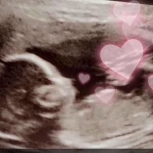 Meet your Posher, Rod