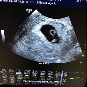 Meet your Posher, Marcos