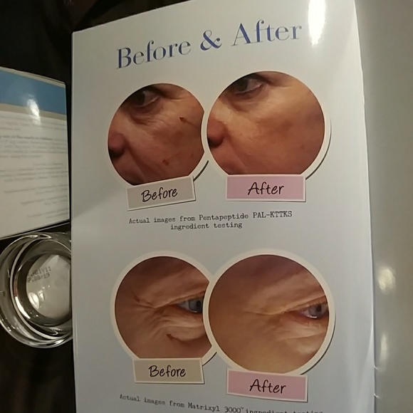 Complexion MD Anti-Wrinkle Cream - Picture 7 of 8