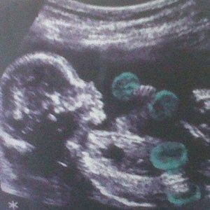 Meet your Posher, Jimmy