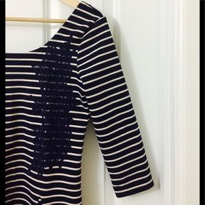 Free People stripe dress with lace details