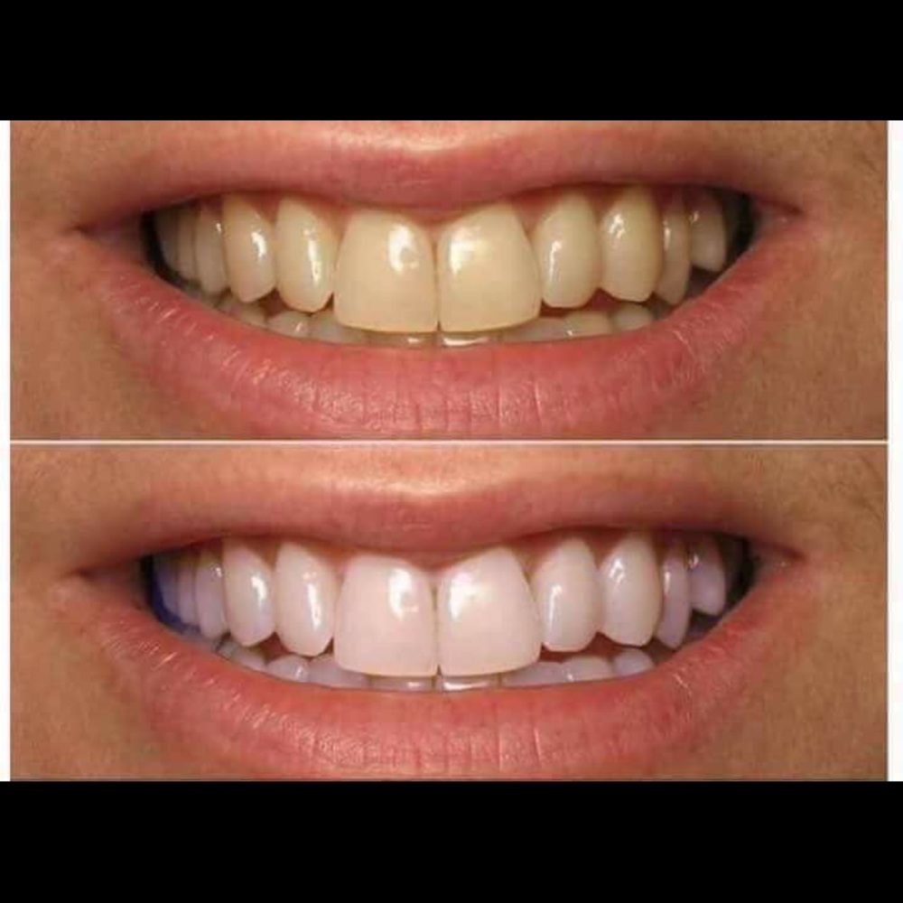 All natural whitening toothpaste