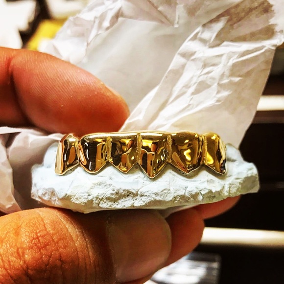 Custom 6 Teeth Grill in 10KT Italian Yellow Gold