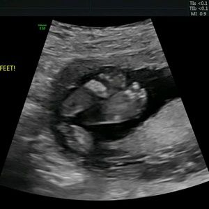 Meet your Posher, Myranda