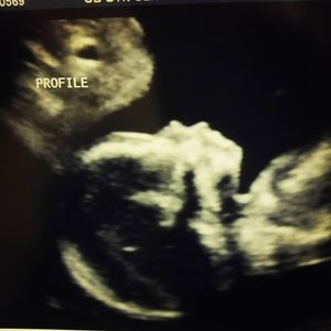 Meet your Posher, Miyagii