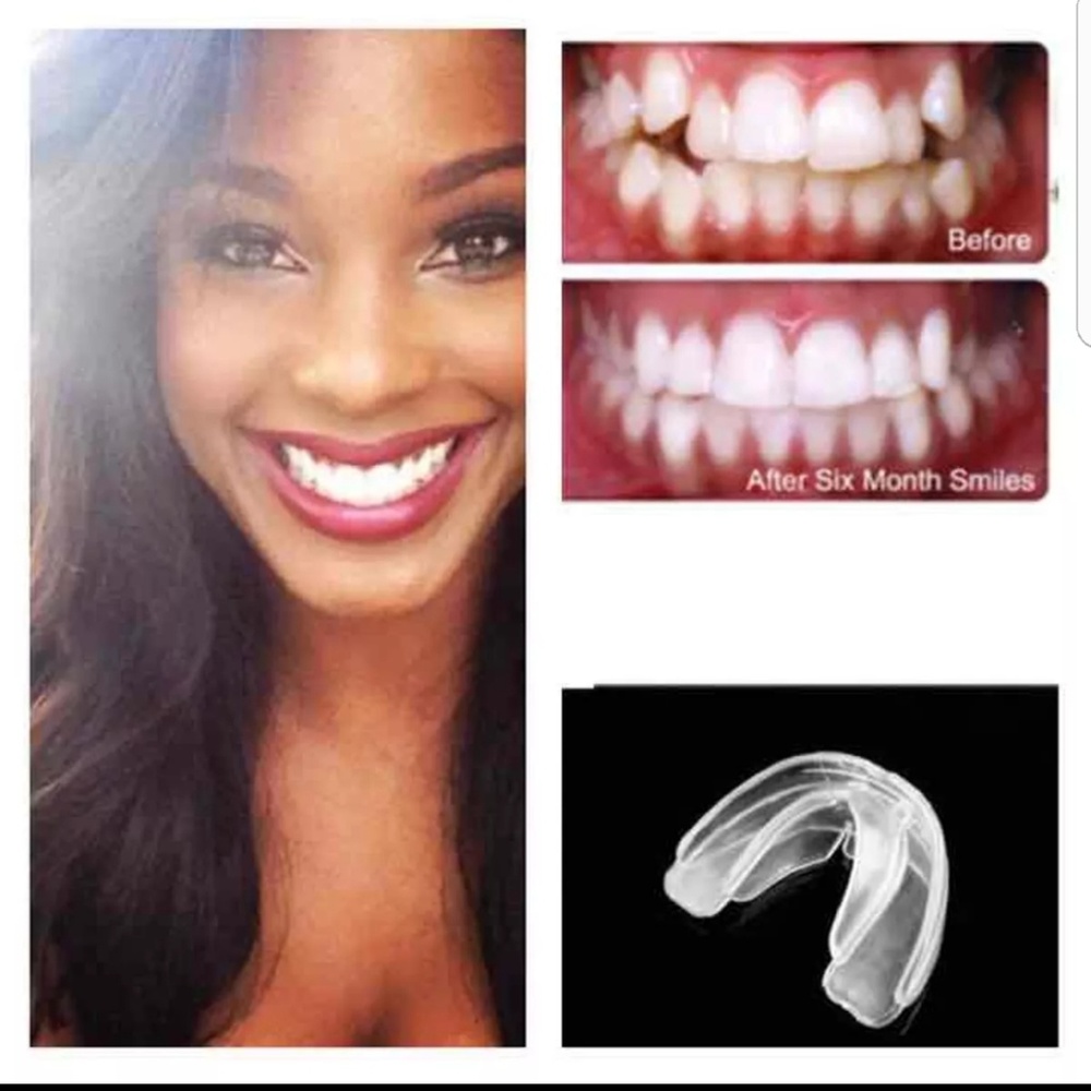 teeth straightening retainer