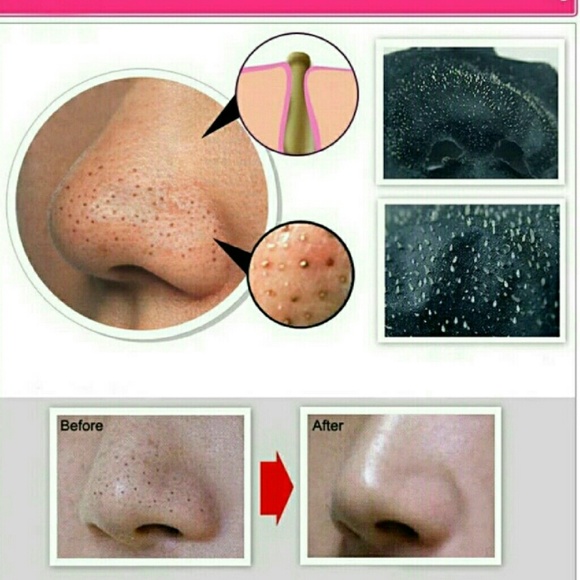 PILATEN BRANDO  BLACKHEARD  REMOVER T DISTRICT - Picture 2 of 3