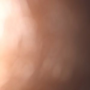 Meet your Posher, Corinthian