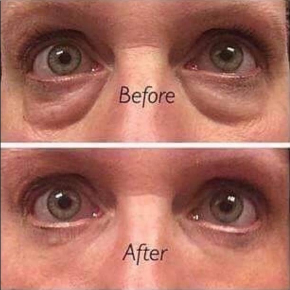 Best dual Eye Serum and Hydrogel Patches