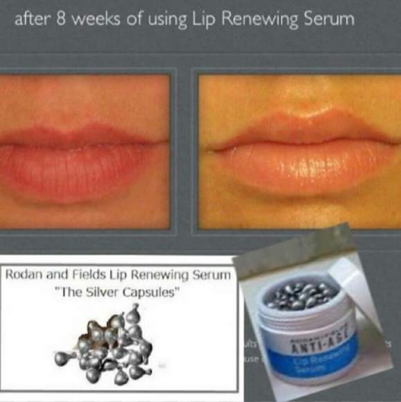 Rodan Fields Lip Renewing Serum - New/Sealed - Picture 6 of 7