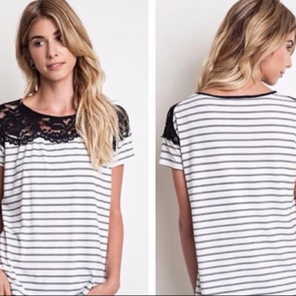 Striped Lace Tunic Dress