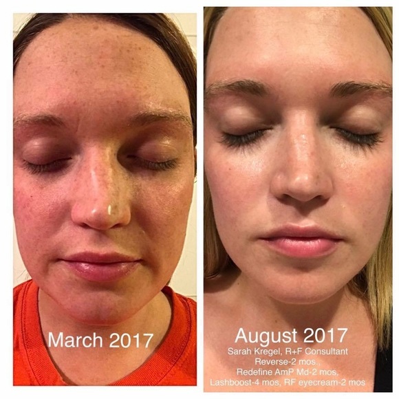 Rodan + Fields - Picture 5 of 5