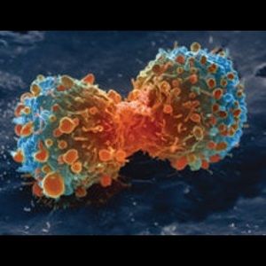 Meet your Posher, Andre