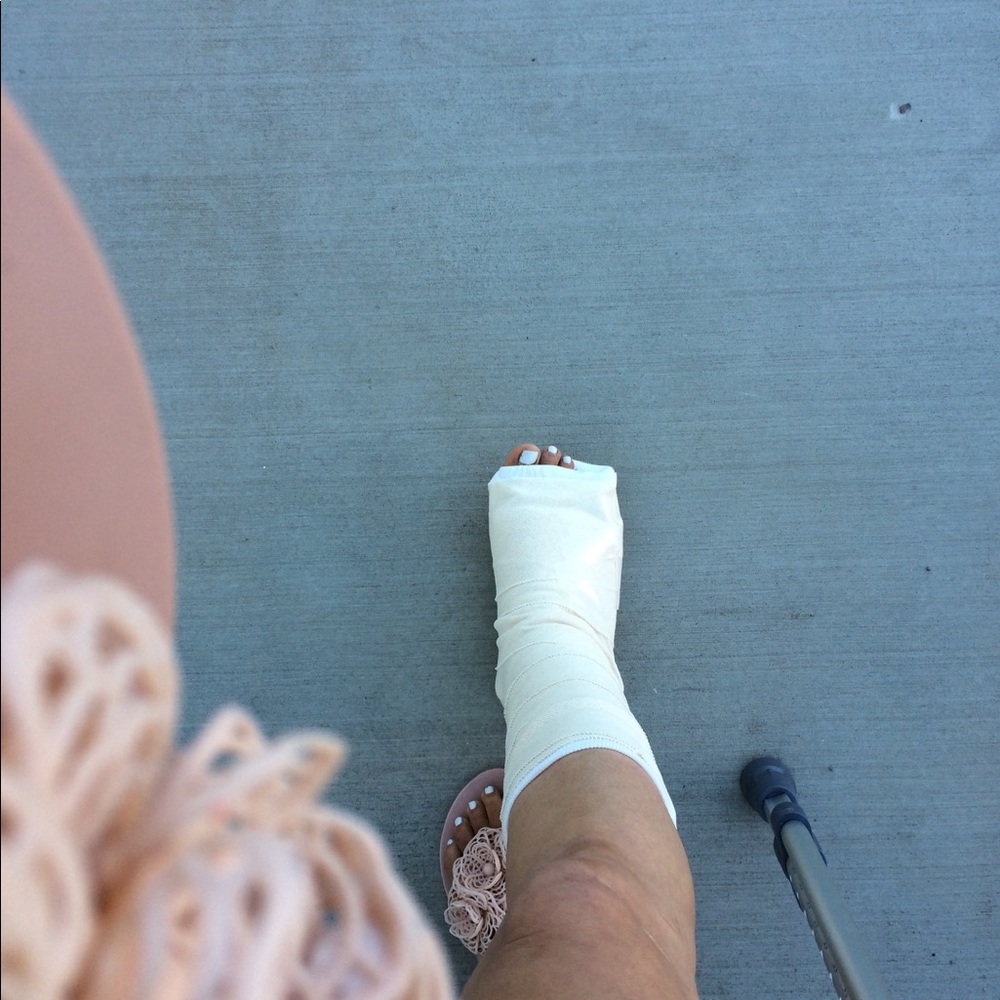 Sorry delayed shipping broken foot😓