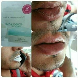 Lip treatment