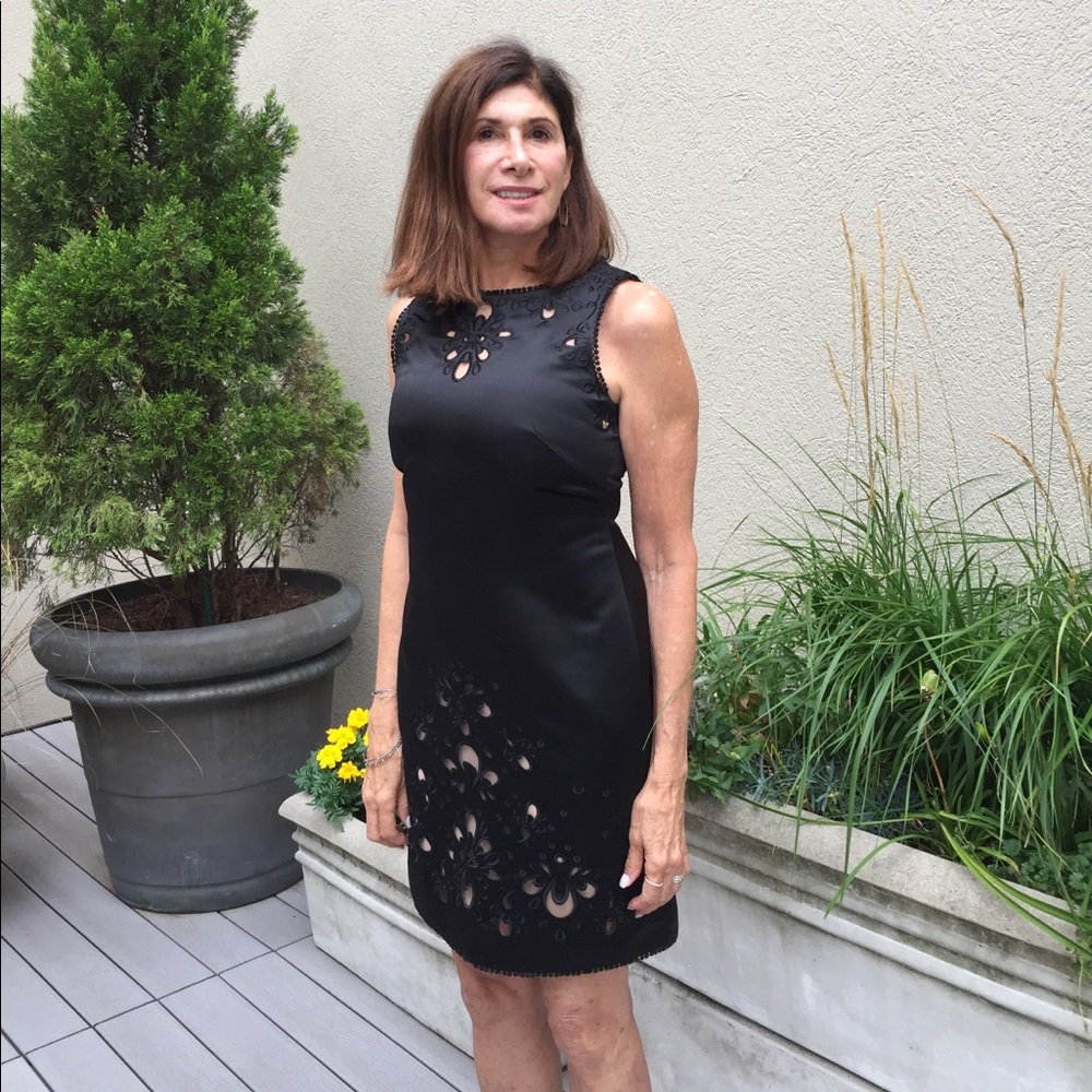 BCBG Black Scallop Cut Out Dress