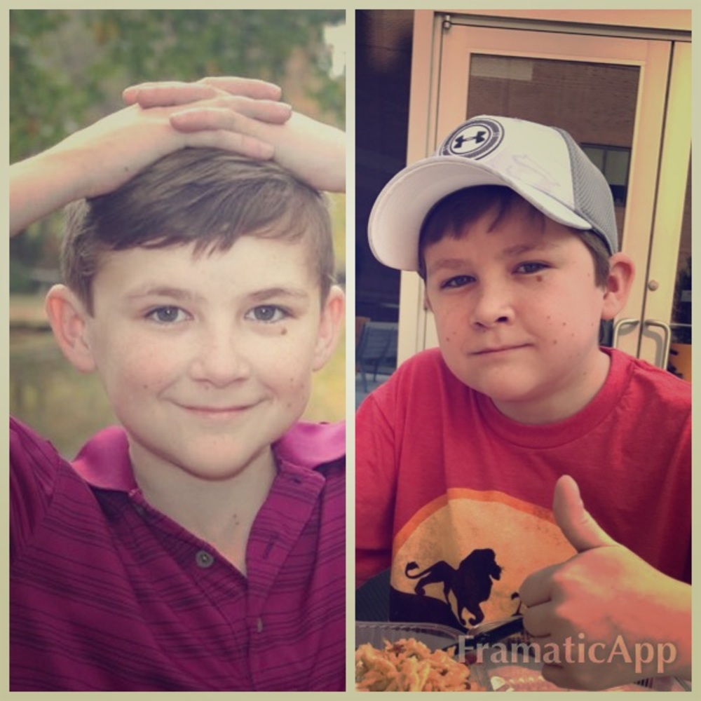 Raising money for this sweet face