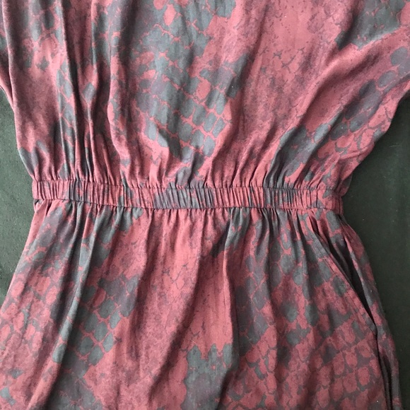 Express Dress - Picture 4 of 5