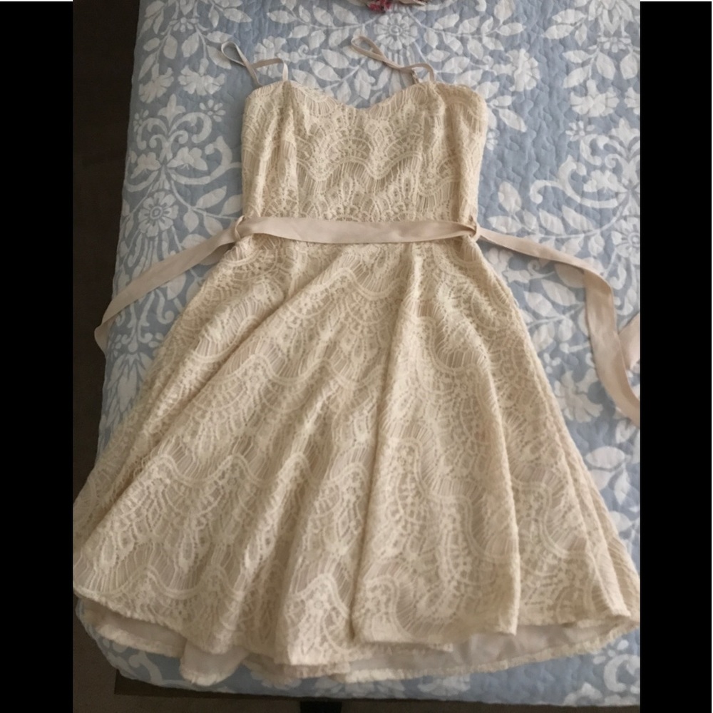 👗 LACE DRESS! 👗